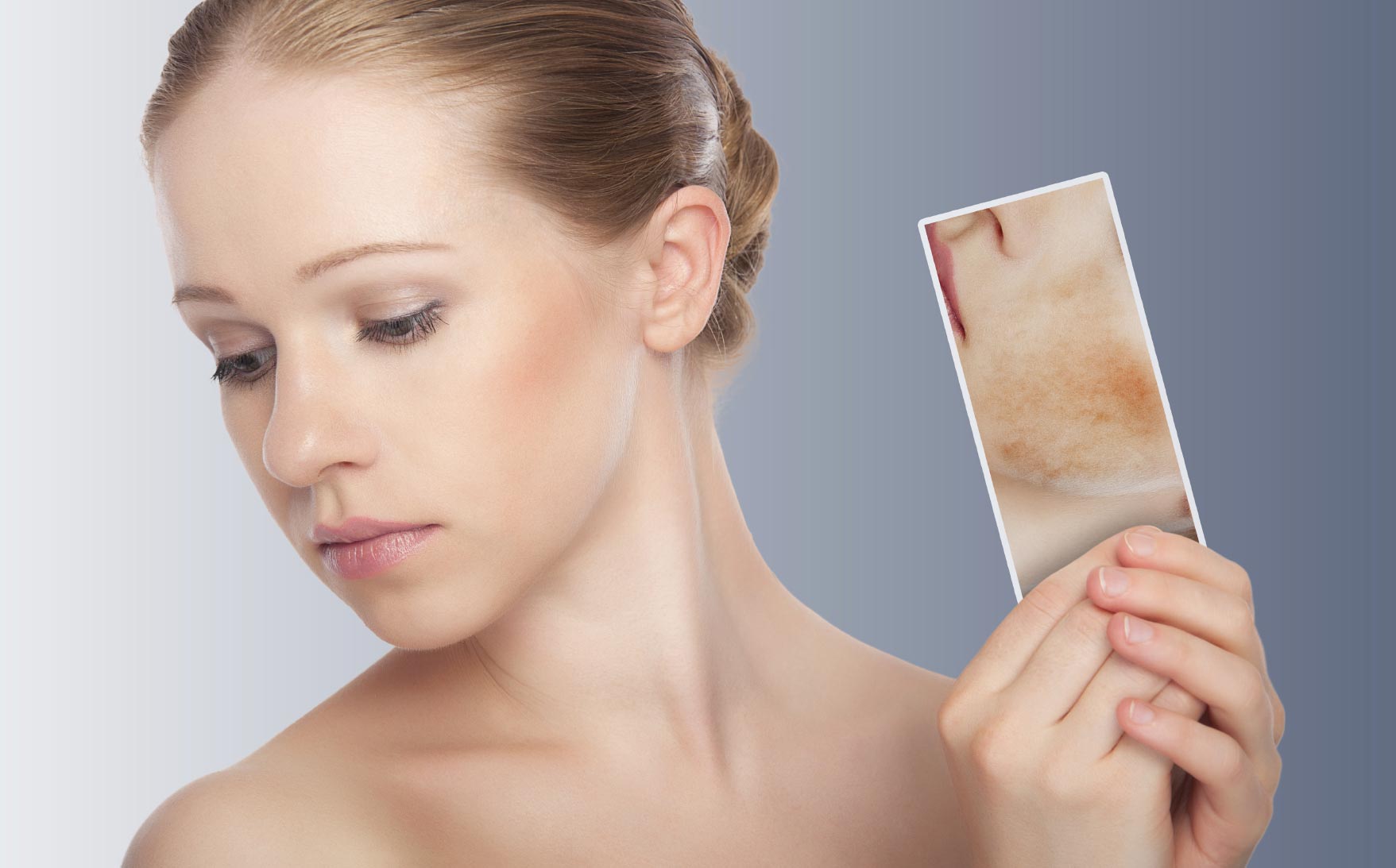 Psoriasi: un problema dermatologico… e non solo!