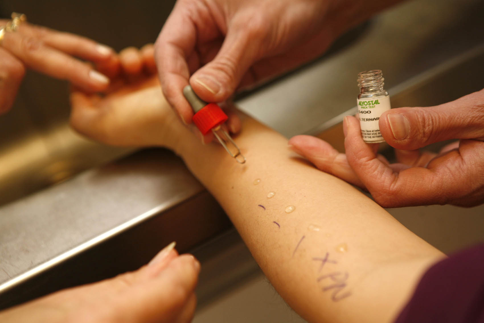Allergie, la quarta causa di malattie croniche