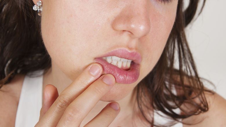 Herpes simplex virus tipo 2 datazione