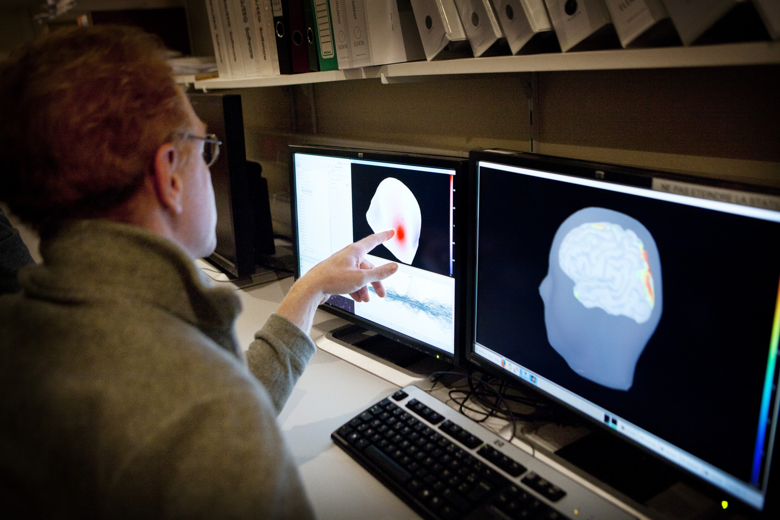 Alzheimer: sì alla diagnosi superprecoce Alzheimer: sì alla diagnosi superprecoce