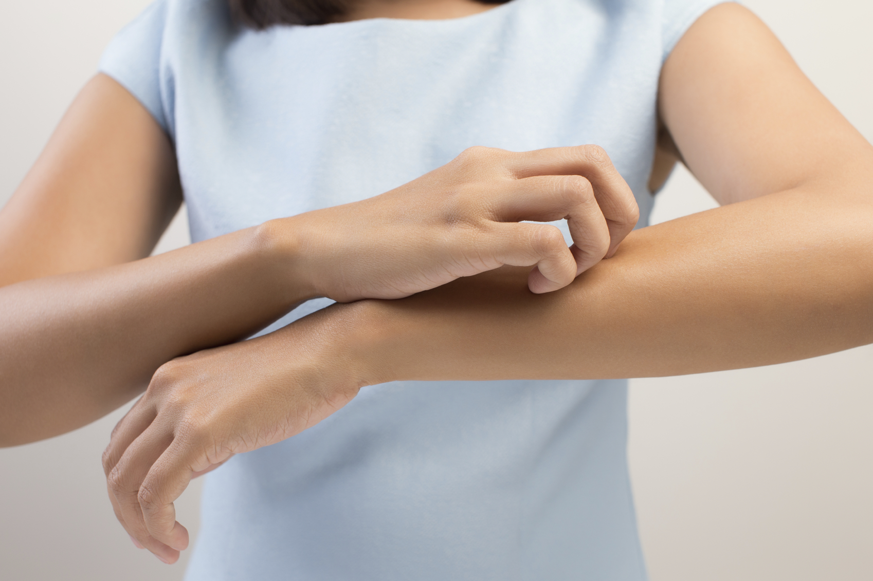 Psoriasi: una patologia sottovalutata