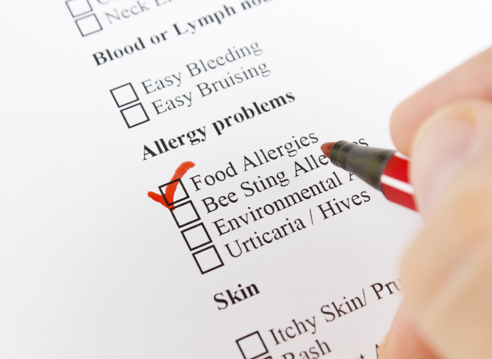Attenzione alle allergie alimentari