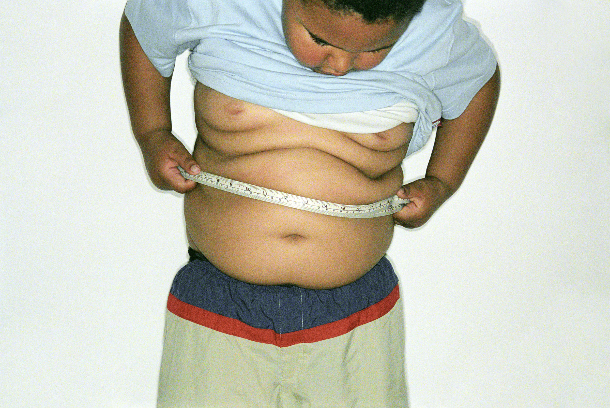 Огромный толстый мальчику. Ожирение у детей и подростков.