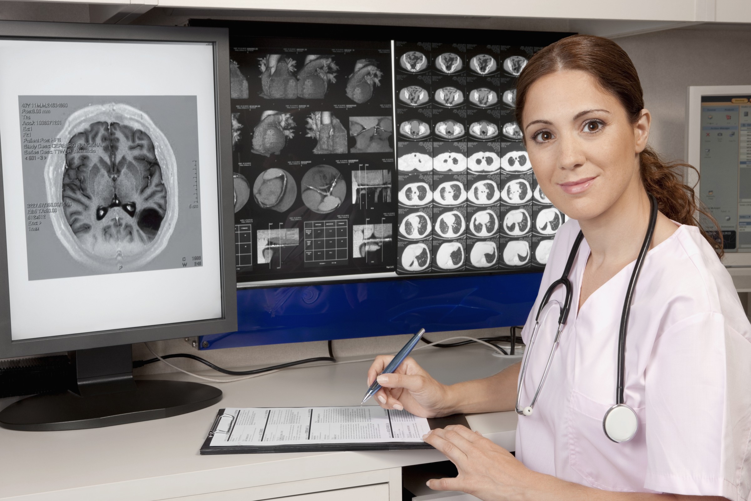 Epilessia: a che punto è la ricerca?
