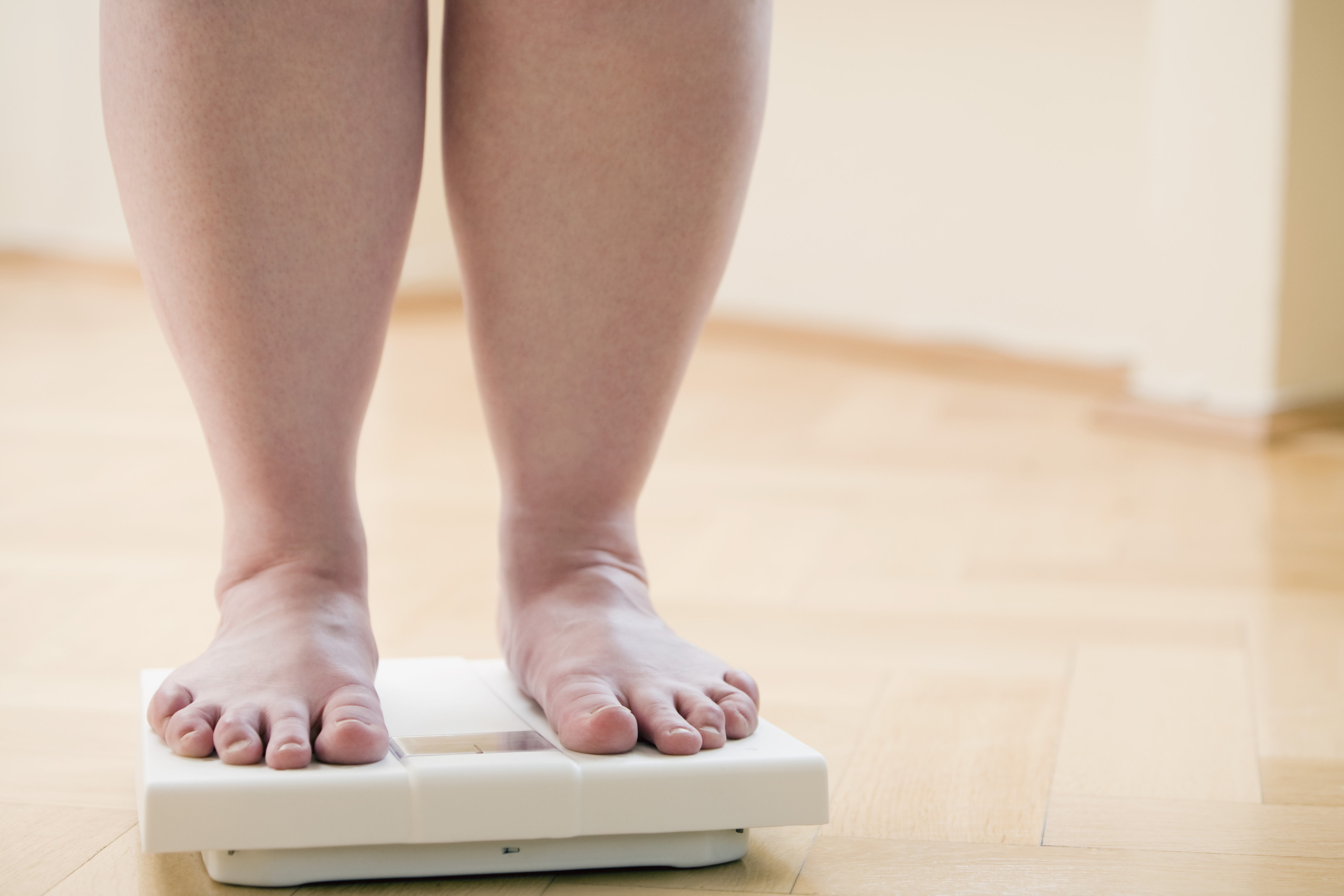 Obesità e salute delle articolazioni Obesità e salute delle articolazioni