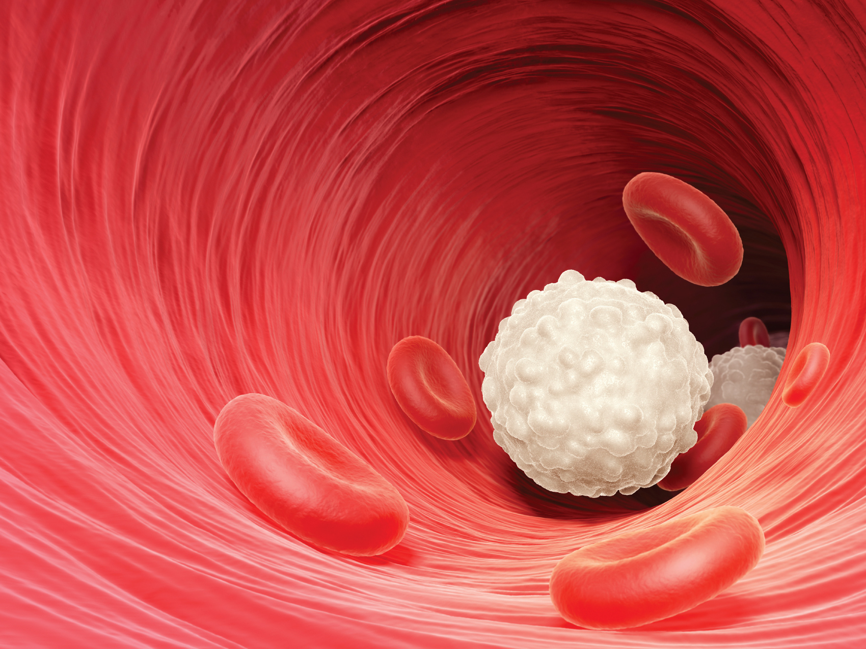 LMA: leucemia mieloide acuta, sintomi, diagnosi, cure