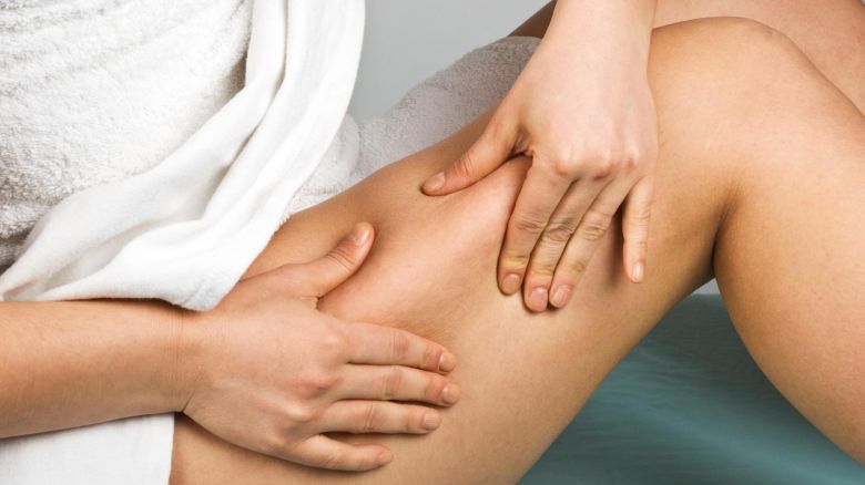 combattere cellulite