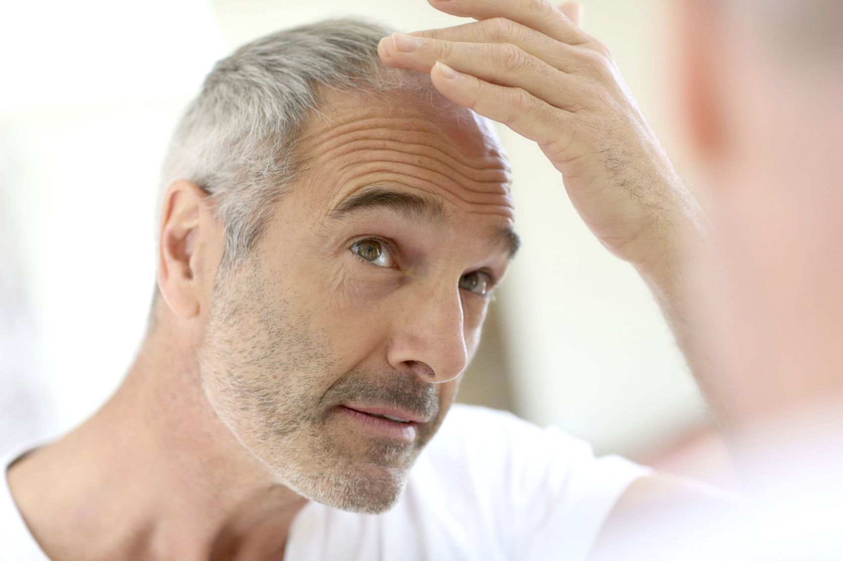Cure per l’alopecia areata: la Prp Cure per l’alopecia areata: la Prp