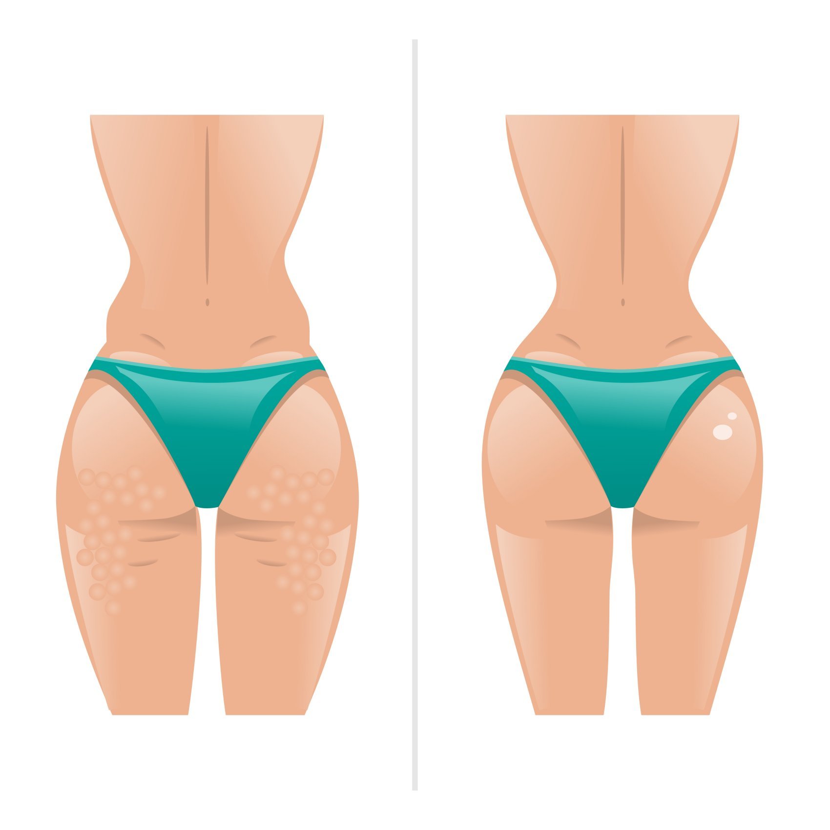 siti per trombare bikini pizza siti per trombare bikini pizza