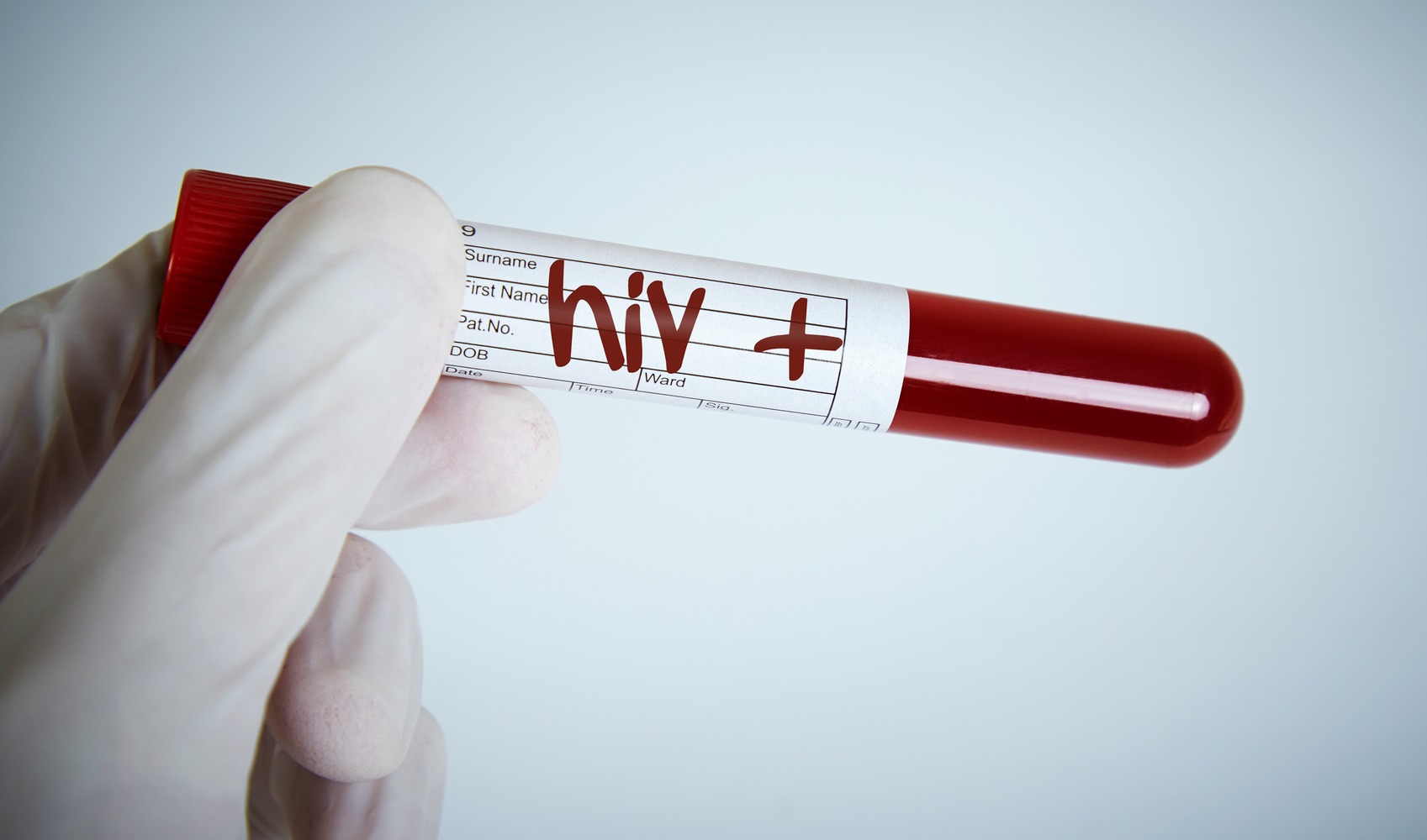 Lotta all’AIDS: il punto della situazione