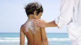 Le creme solari, Dott.ssa Bucci