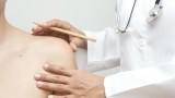 La psoriasi, Dott.ssa Bucci