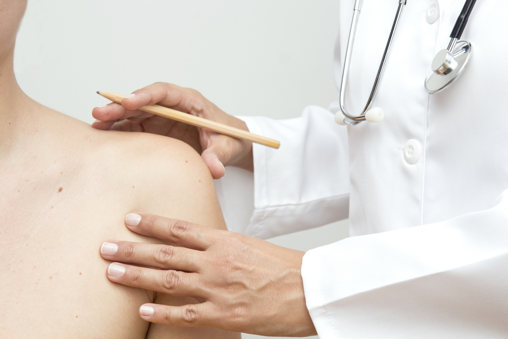 La psoriasi, Dott.ssa Bucci