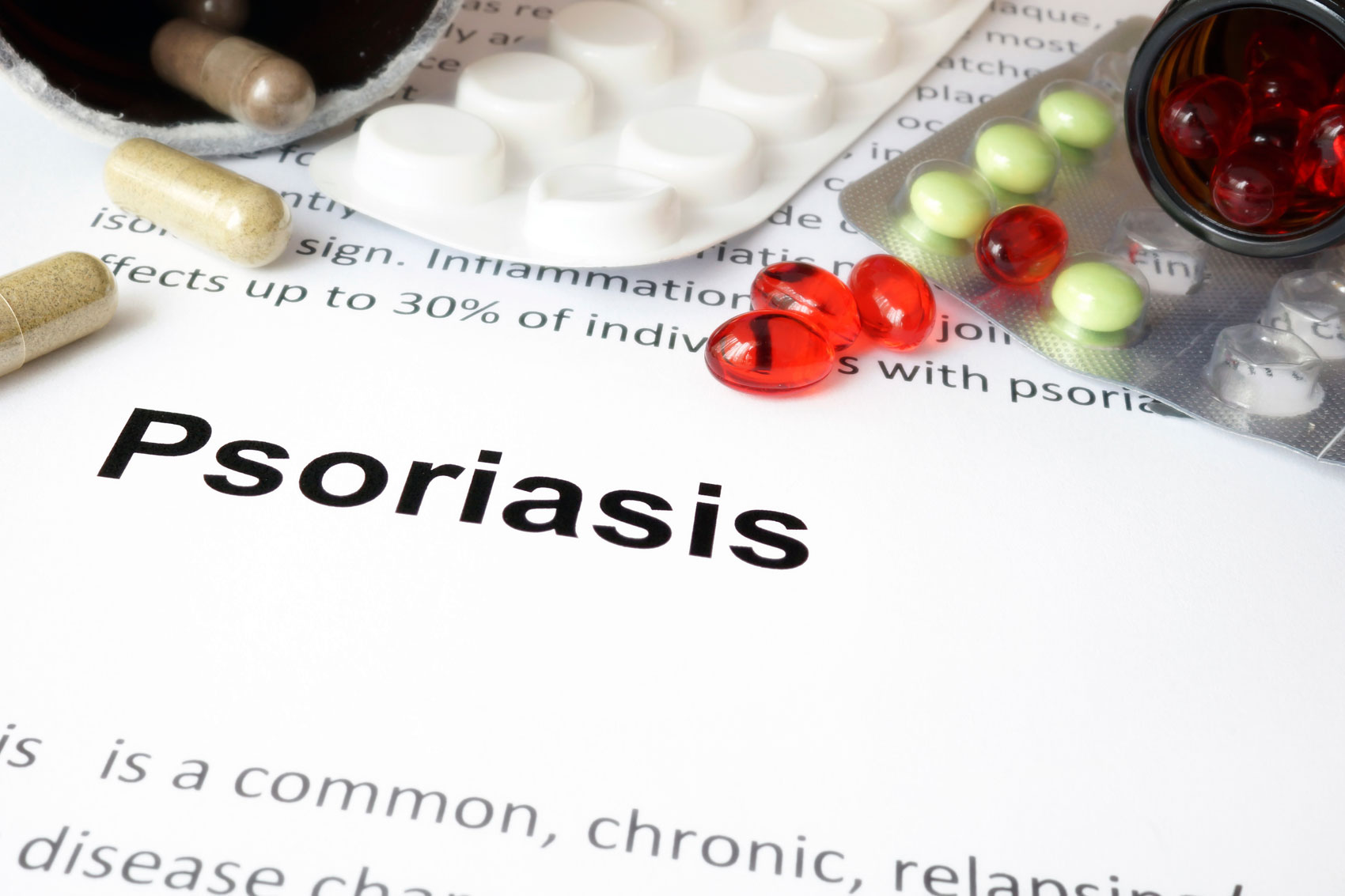 Psoriasi: via le macchie con le nuove cure Psoriasi: via le macchie con le nuove cure