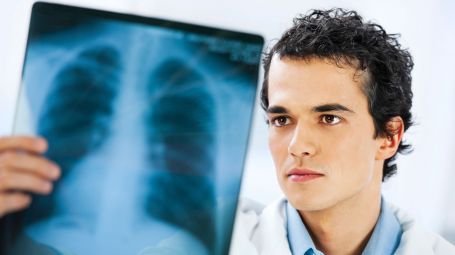 medico guarda lastra polmoni
