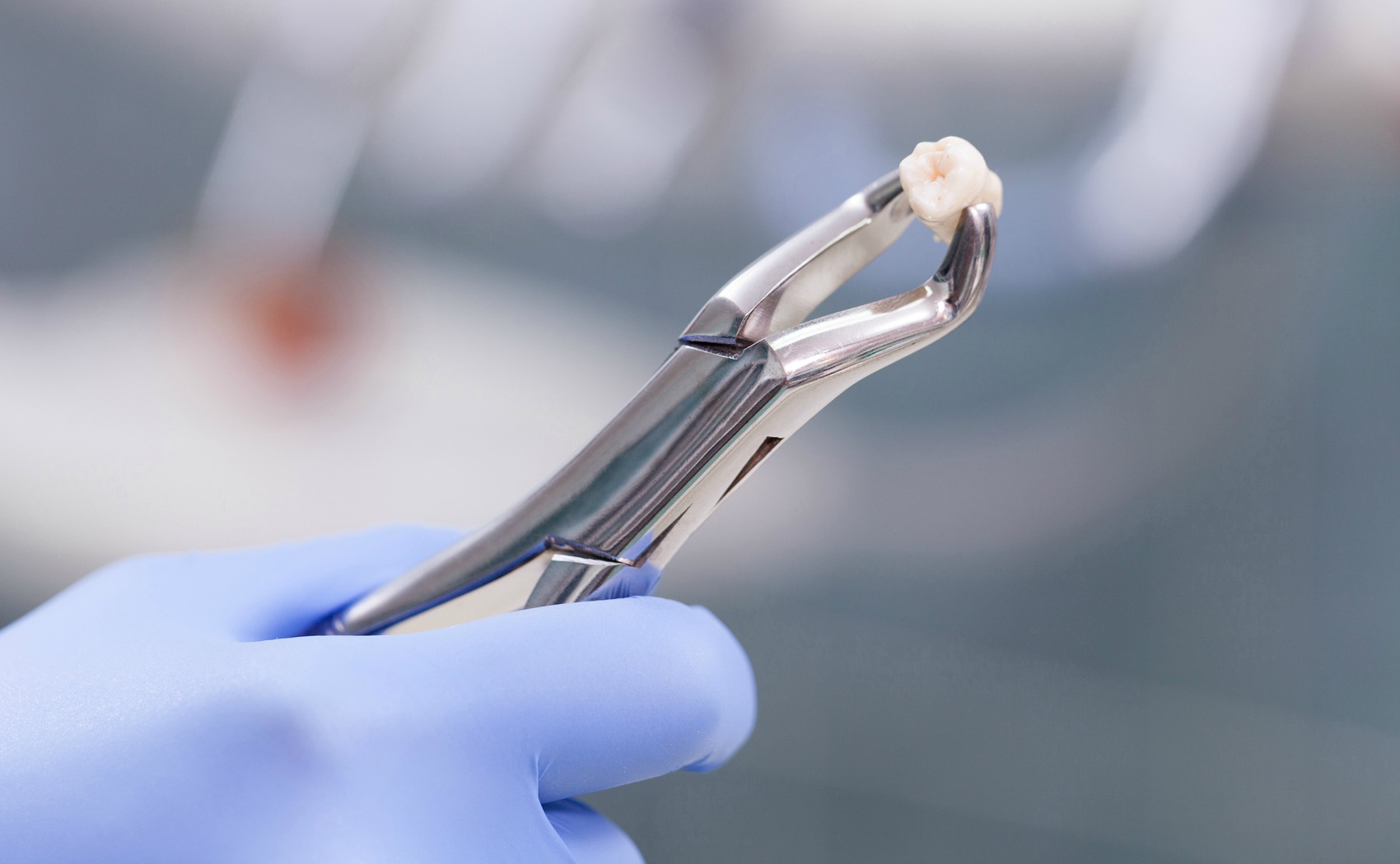 Perdita dei denti: cause e rimedi
