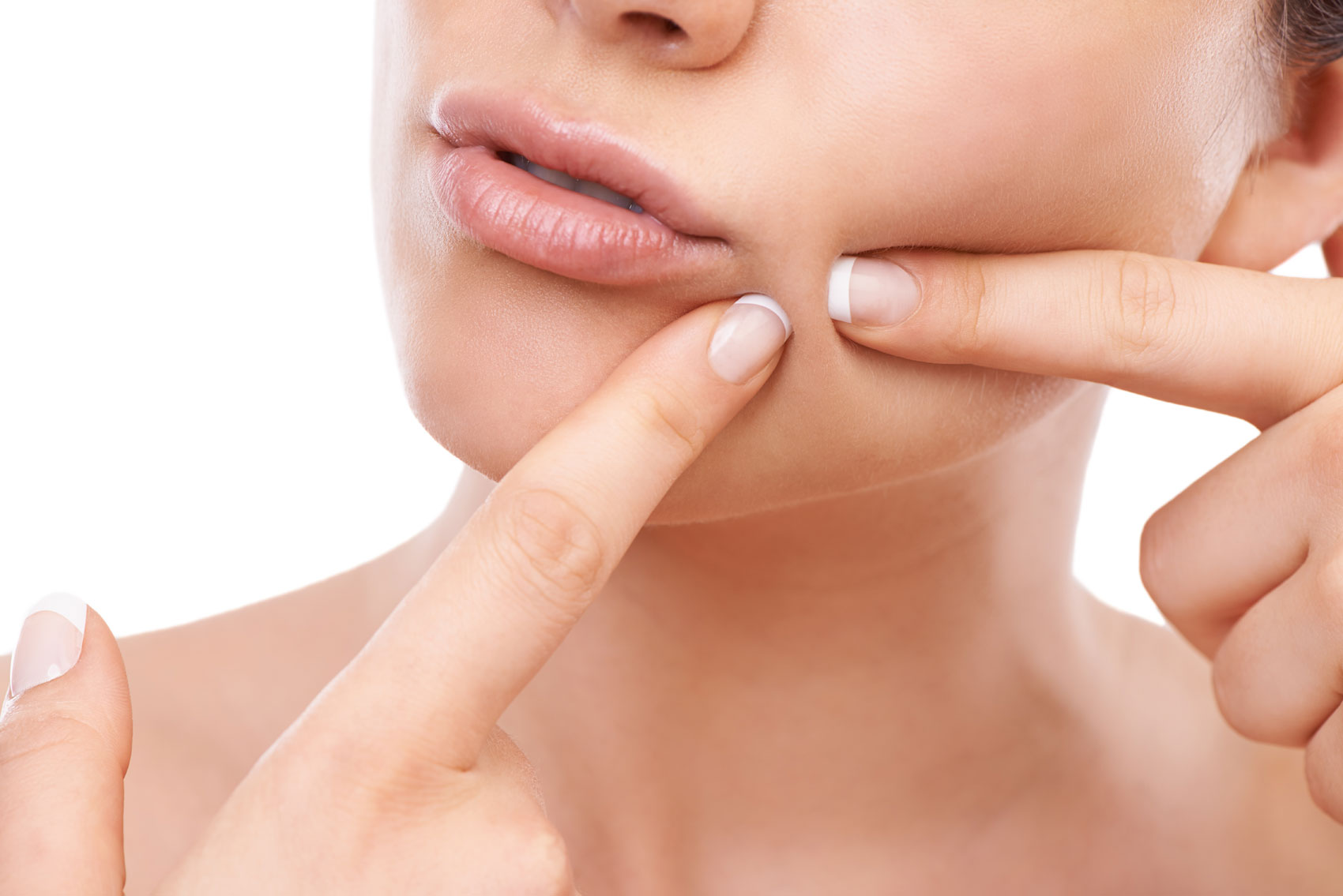 Acne: quali sono le nuove tecniche per combatterla