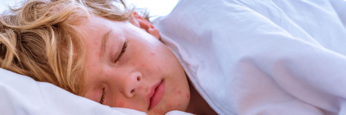 Podcast Il morbillo, Professor Pregliasco