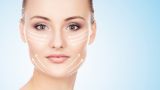 Collagene: che cos’è e dove si trova