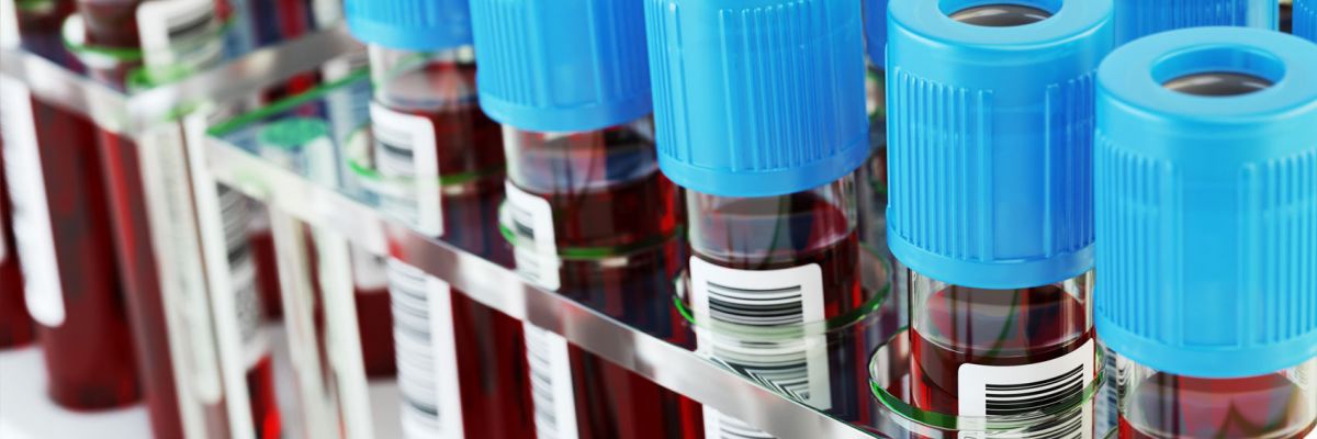 Podcast Prevedere i tumori dal sangue