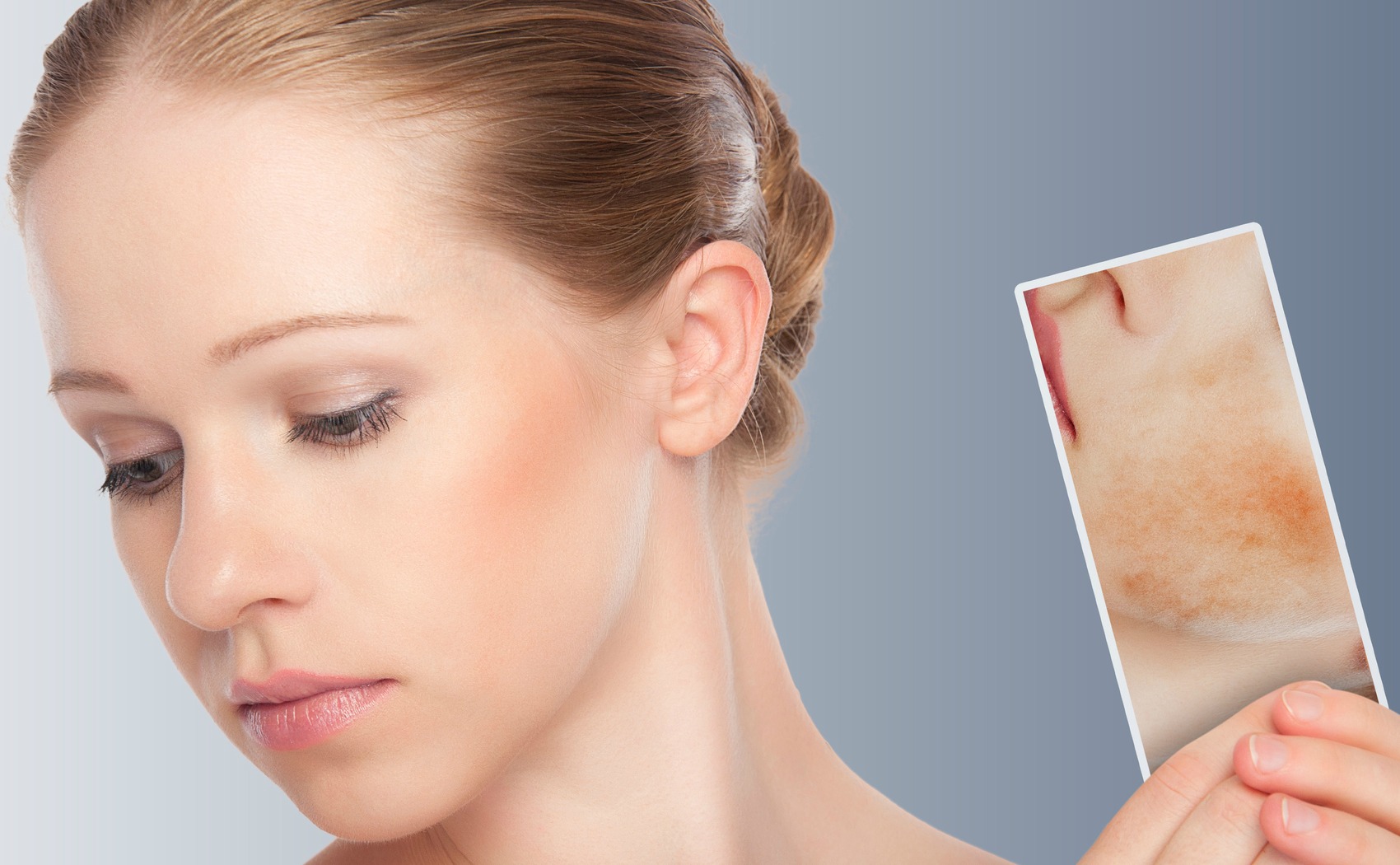Dermatite atopica: perché va curata con dolcezza