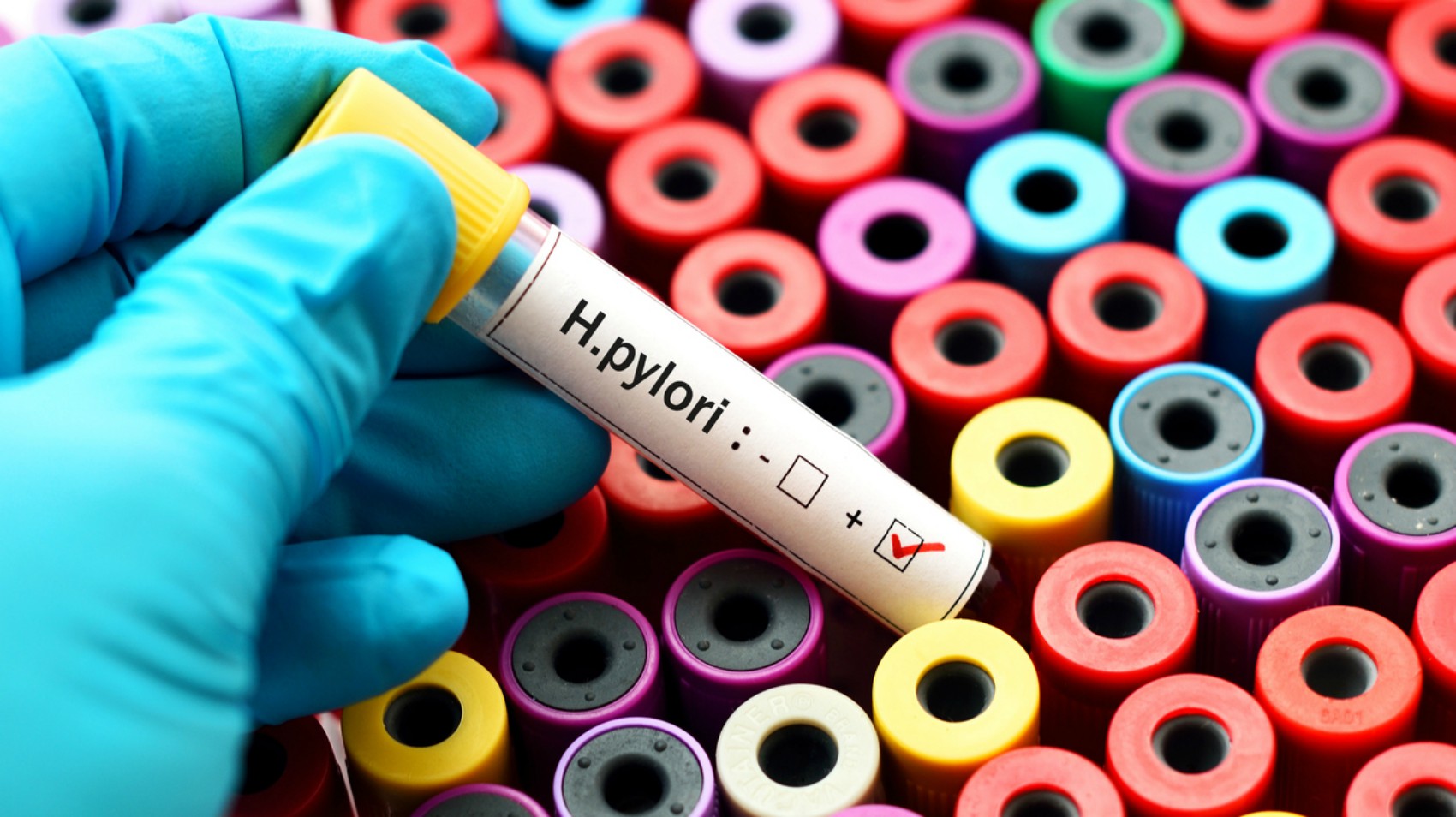 Helicobacter pylori: quali sono i segnali rivelatori Helicobacter pylori: quali sono i segnali rivelatori