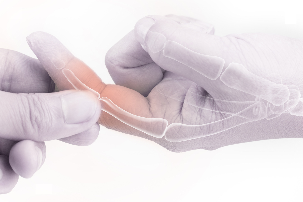 Artrite reumatoide: sintomi, cause e cure
