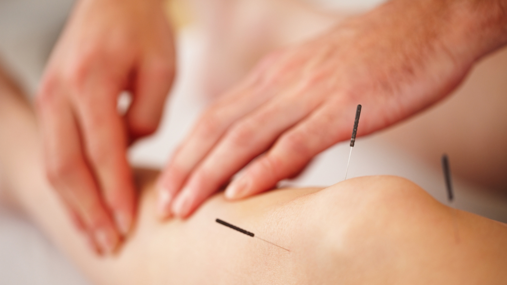 Pancia Gonfia Come Curarla Con La Medicina Cinese