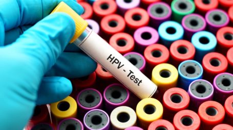 hpv test