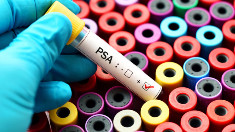 Esame della prostata: a quale età si deve iniziare a fare i controlli?
