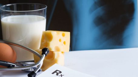 osteoporosi, calcio, ossa, latte, uova