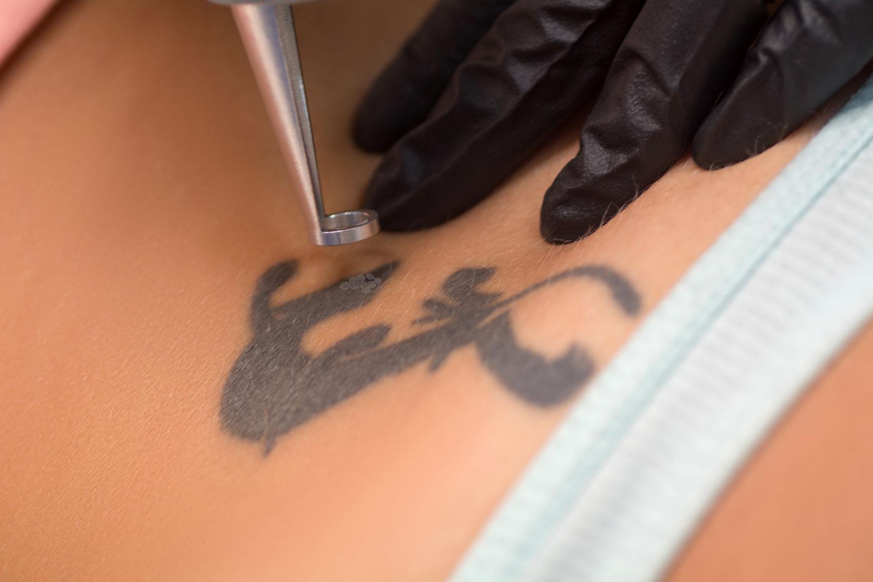 Tatuaggi, la guida completa: come funzionano e quali sono i reali rischi