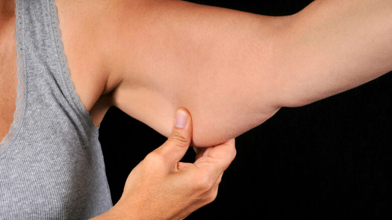 Menopausa: braccia a tendina, quando serve la pillola, durata delle vampate Menopausa: braccia a tendina, quando serve la pillola, durata delle vampate