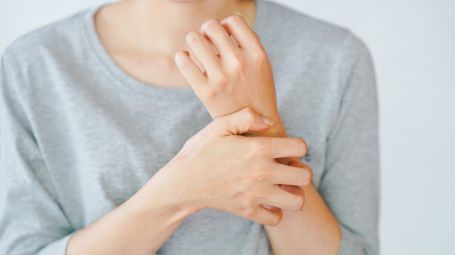 psoriasi, prurito, pelle, mani