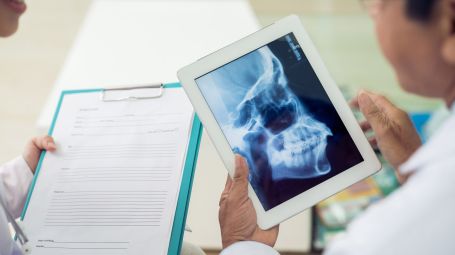 dottori, radiografia, mandibola, teschio, raggi x