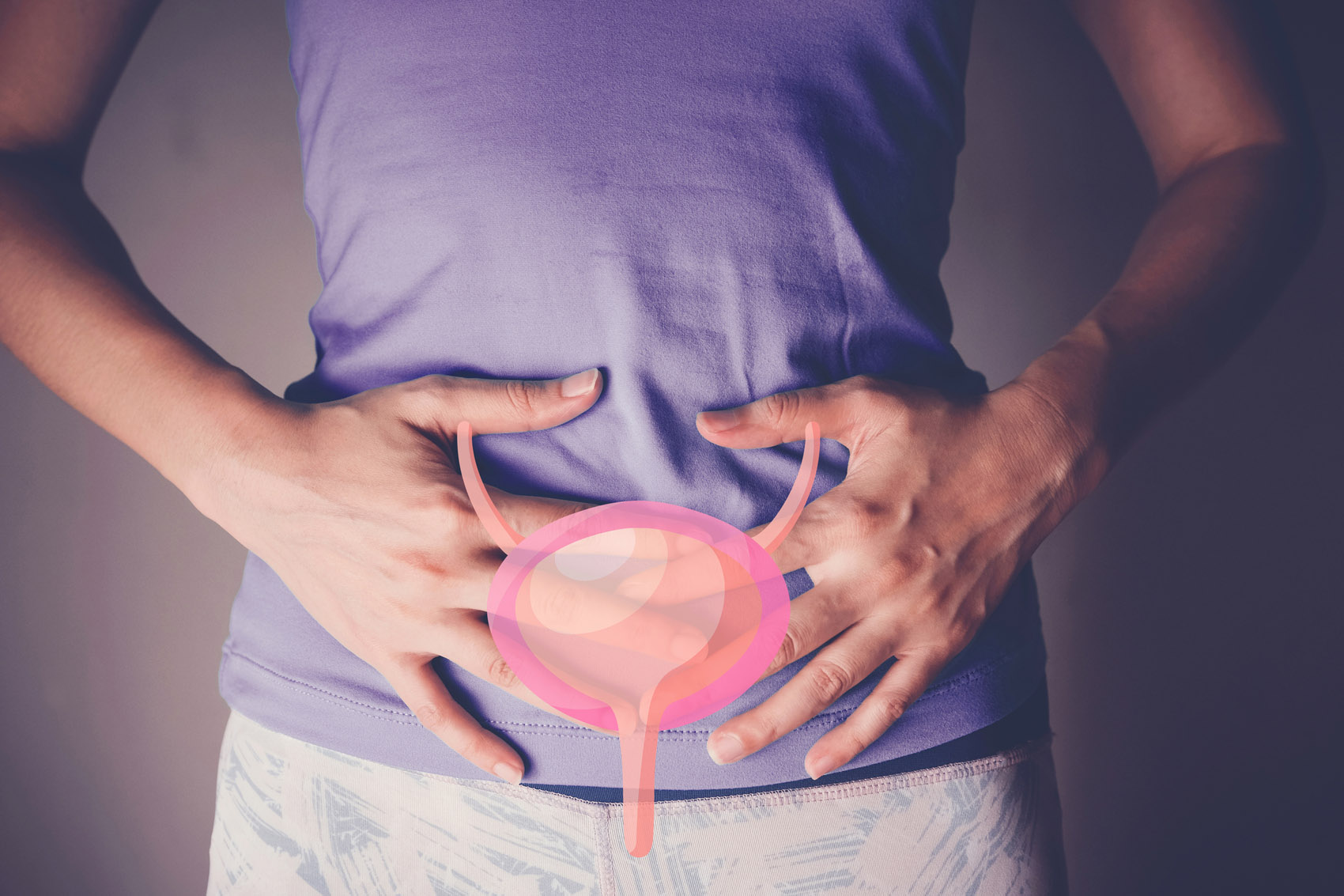Donna e vescica, cistite, uretrite e incontinenza urinaria, concetto di cancro della vescica