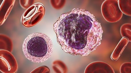 linfocita, a sinistra, e monocita, a destra, tra globuli rossi