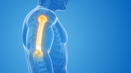 spalla, omero, braccio