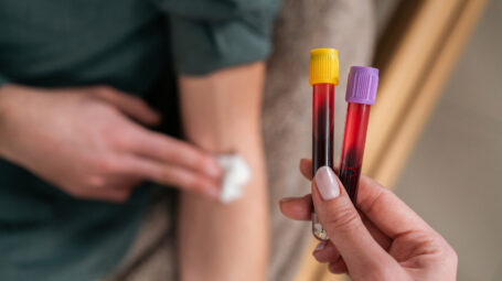 Esami del sangue: la guida completa alle analisi del sangue