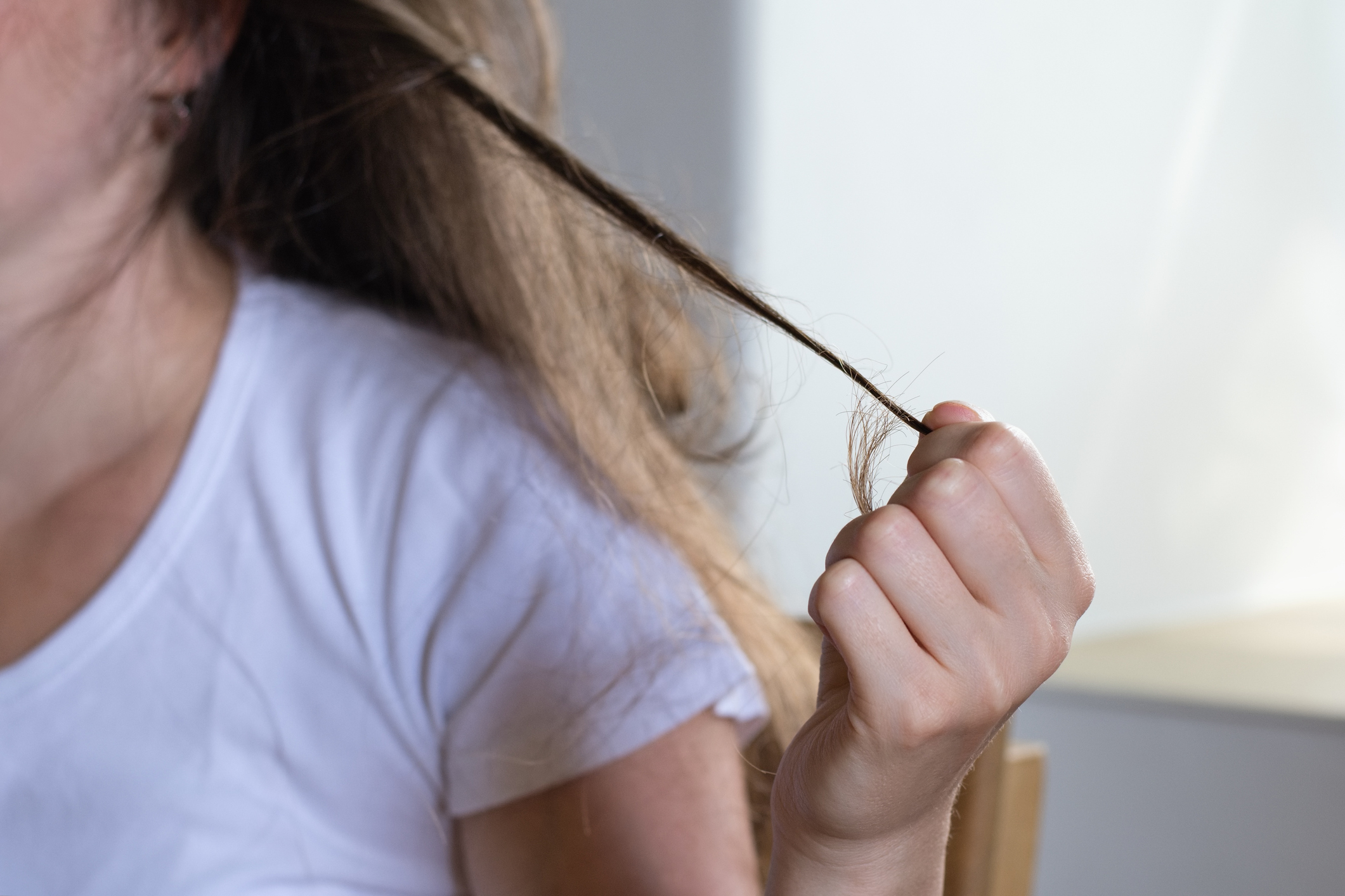 Tricotillomania: cos’è, sintomi, cause, cure