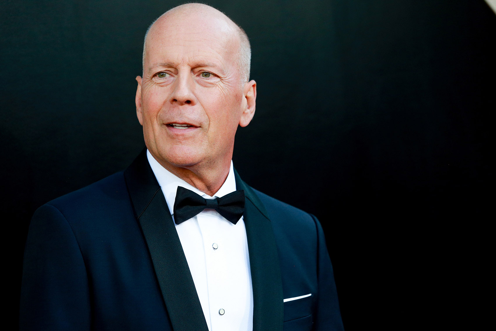 Demenza frontotemporale: cos’è la malattia che ha colpito Bruce Willis Demenza frontotemporale: cos’è la malattia che ha colpito Bruce Willis