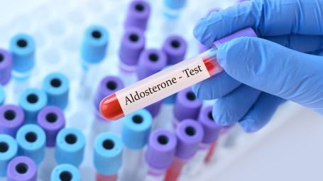Aldosterone, sangue, test
