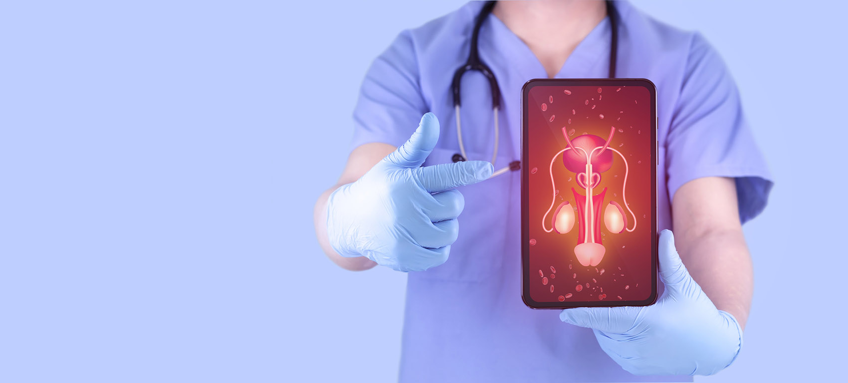 Malattia di La Peyronie, la nuova terapia non chirurgica per il pene curvo