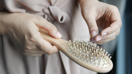 Caduta capelli e alopecia androgenetica o areata: cosa fare