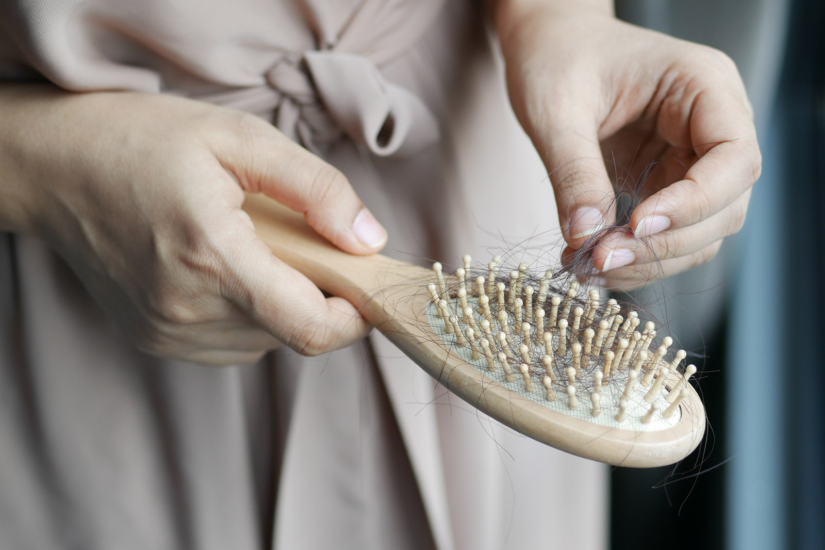 Caduta capelli e alopecia androgenetica o areata: cosa fare