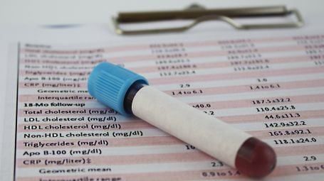 Ipercolesterolemia familiare: cos’è, cause, sintomi, cure