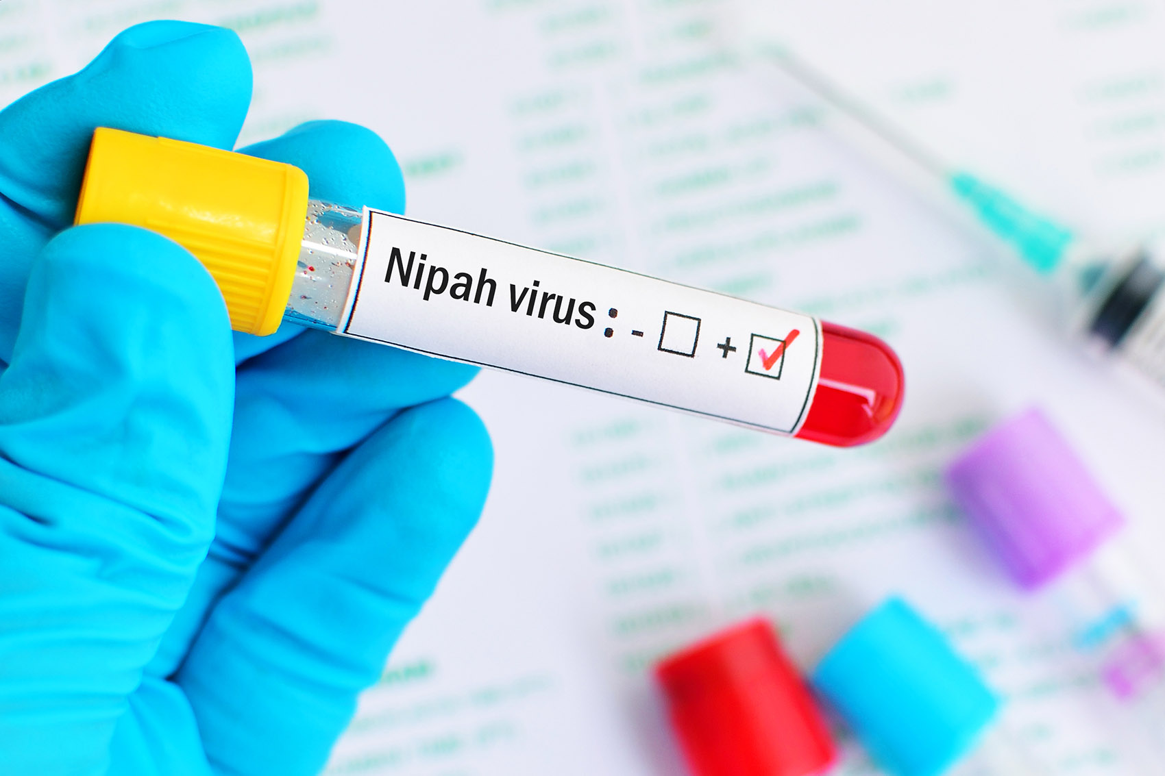 Virus Nipah,  perché preoccupa e cosa sappiamo