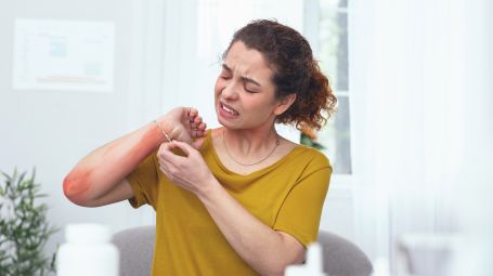 Dermatite, le varie forme: decodifica così l’SOS della tua pelle