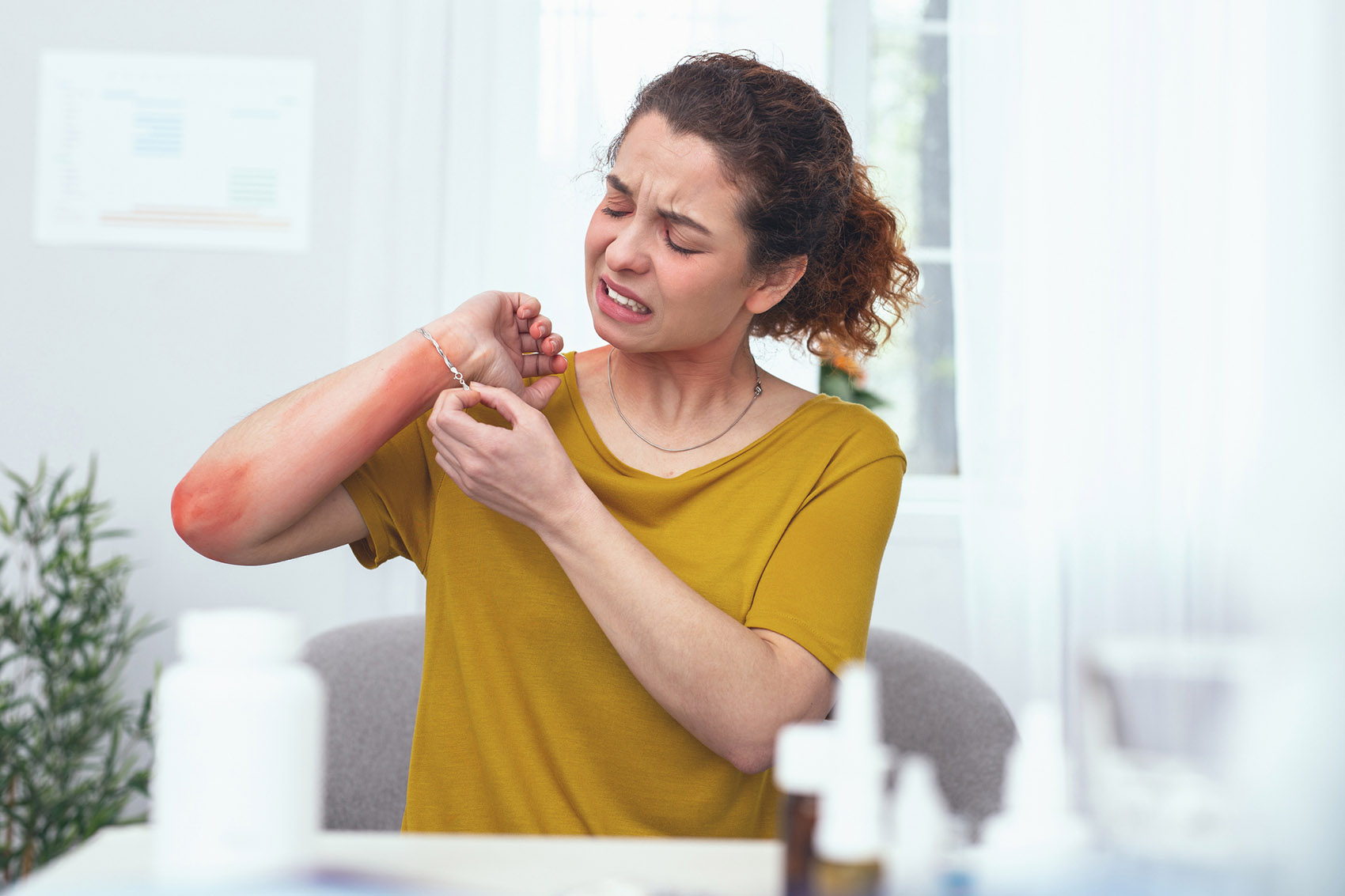 Dermatite, le varie forme: decodifica così l’SOS della tua pelle
