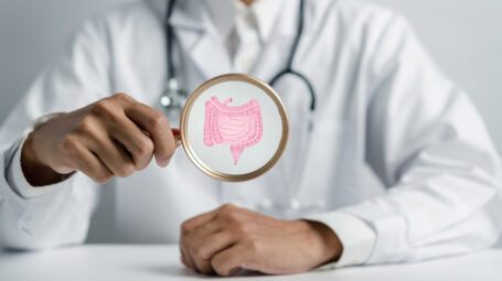 Tumore del retto, a Milano si elimina senza chirurgia e sacchetto